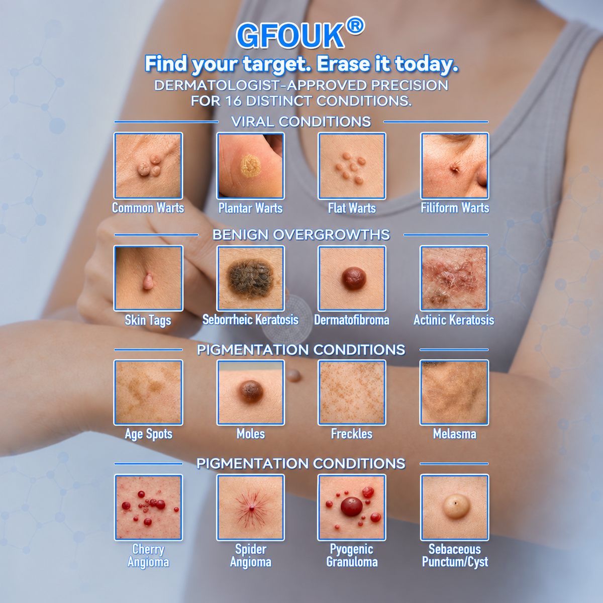 🌟 𝐎𝐟𝐟𝐢𝐜𝐢𝐚𝐥 𝐒𝐭𝐨𝐫𝐞 | GFOUK®  🍃𝐁𝐨𝐭𝐚𝐧𝐢𝐜𝐚𝐥 𝐌𝐢𝐜𝐫𝐨𝐧𝐞𝐞𝐝𝐥𝐞 𝐇𝐲𝐝𝐫𝐨𝐜𝐨𝐥𝐥𝐨𝐢𝐝 𝐏𝐚𝐭𝐜𝐡 (𝐅𝐨𝐫 𝐒𝐤𝐢𝐧 𝐓𝐚𝐠𝐬, 𝐒𝐦𝐚𝐥𝐥 𝐒𝐤𝐢𝐧 𝐆𝐫𝐨𝐰𝐭𝐡𝐬, 𝐖𝐚𝐫𝐭𝐬, 𝐌𝐨𝐥𝐞𝐬, 𝐀𝐠𝐞 𝐒𝐩𝐨𝐭𝐬 & 𝐏𝐢𝐠𝐦𝐞𝐧𝐭𝐚𝐭𝐢𝐨𝐧 𝐂𝐨𝐧𝐜𝐞𝐫𝐧𝐬)