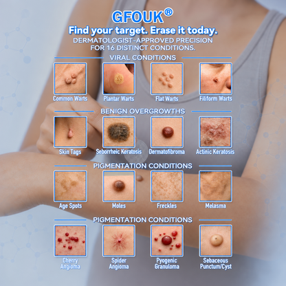 🌟 𝐎𝐟𝐟𝐢𝐜𝐢𝐚𝐥 𝐒𝐭𝐨𝐫𝐞 | GFOUK®  🍃𝐁𝐨𝐭𝐚𝐧𝐢𝐜𝐚𝐥 𝐌𝐢𝐜𝐫𝐨𝐧𝐞𝐞𝐝𝐥𝐞 𝐇𝐲𝐝𝐫𝐨𝐜𝐨𝐥𝐥𝐨𝐢𝐝 𝐏𝐚𝐭𝐜𝐡 (𝐅𝐨𝐫 𝐒𝐤𝐢𝐧 𝐓𝐚𝐠𝐬, 𝐒𝐦𝐚𝐥𝐥 𝐒𝐤𝐢𝐧 𝐆𝐫𝐨𝐰𝐭𝐡𝐬, 𝐖𝐚𝐫𝐭𝐬, 𝐌𝐨𝐥𝐞𝐬, 𝐀𝐠𝐞 𝐒𝐩𝐨𝐭𝐬 & 𝐏𝐢𝐠𝐦𝐞𝐧𝐭𝐚𝐭𝐢𝐨𝐧 𝐂𝐨𝐧𝐜𝐞𝐫𝐧𝐬)