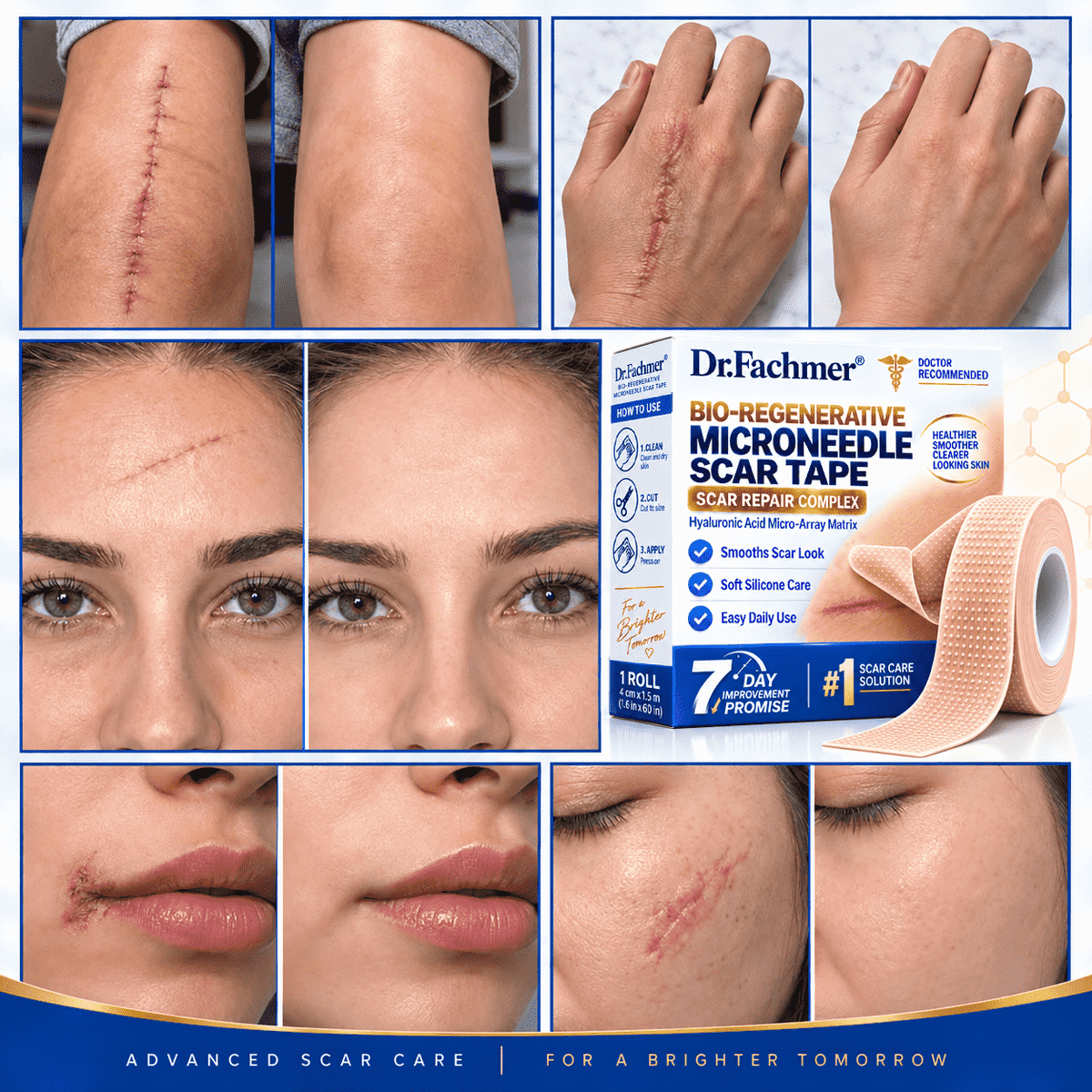 🐬Dr.Fachmer® Bio-Regenerative Microneedle Scar Tape