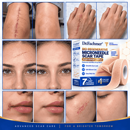 🐬Dr.Fachmer® Bio-Regenerative Microneedle Scar Tape
